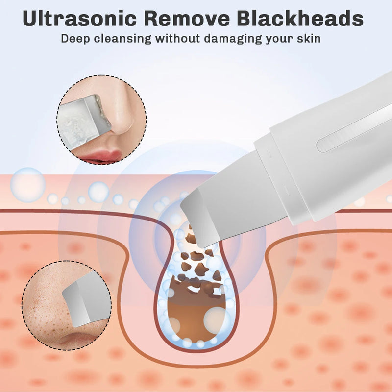 Espátula Ultrassônica Facial 4 em 1 – Limpeza Profunda, Lifting, Extração de Cravos e Rejuvenescimento com Luz LED